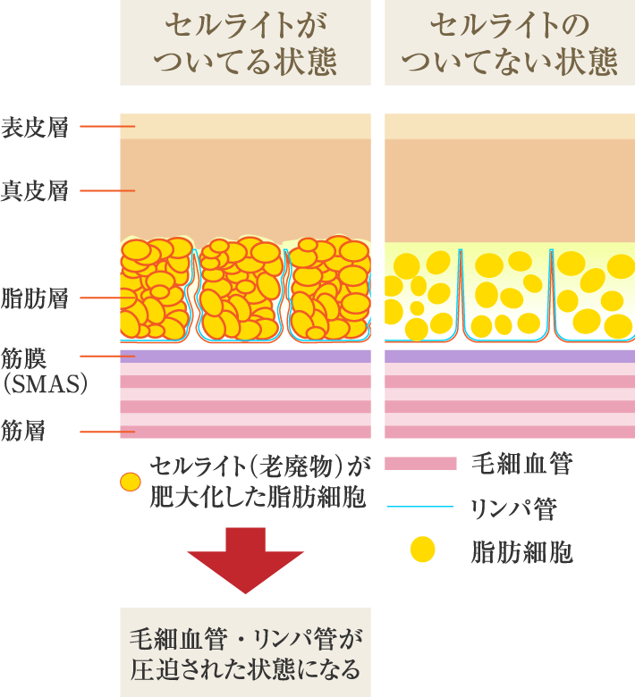 続けるほど痩せやすいキレイなボディにエンダモロジー